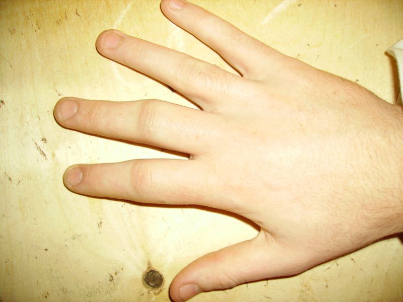 Poor Finger