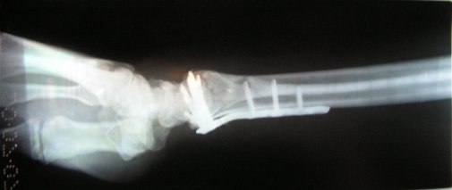 X-Rays1