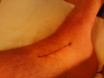 My scar